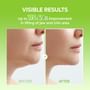 CACTOX V-Line Mask